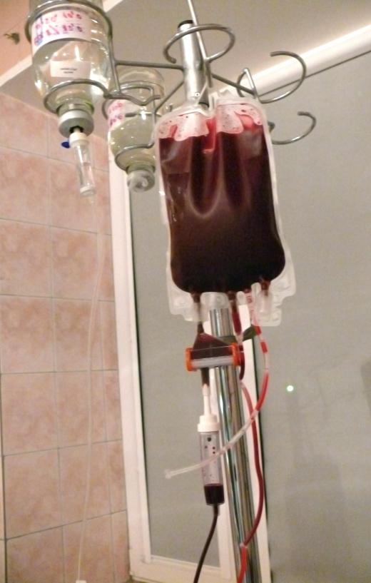Isaac Asimov died of AIDS, which he contracted during a blood transfusion.